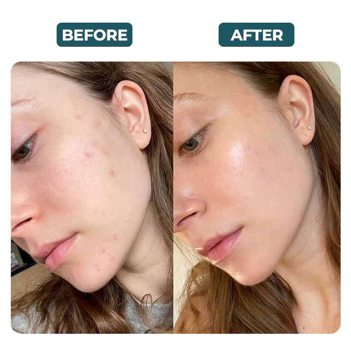 before_and_after_my_vitamin_c_mask_800x